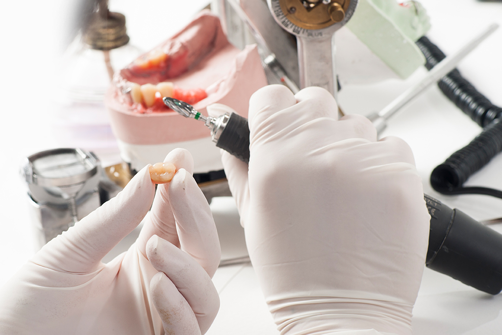 ODs Dental Laboratory- Tustin, CA- Dental Prosthetics