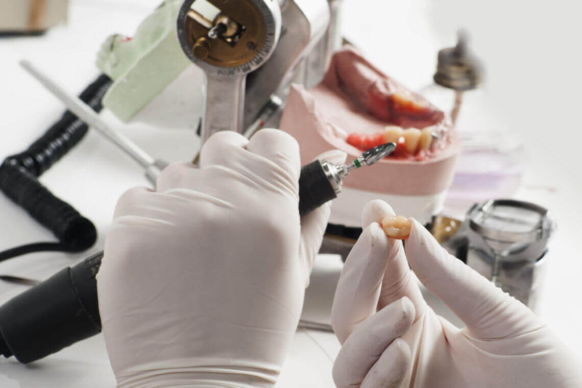 ODs Dental Laboratory Tustin, CA Everest Dental Lab