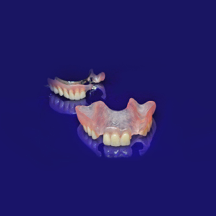 ODs Dental Laboratory- Tustin, CA- Cosmetic Flexible