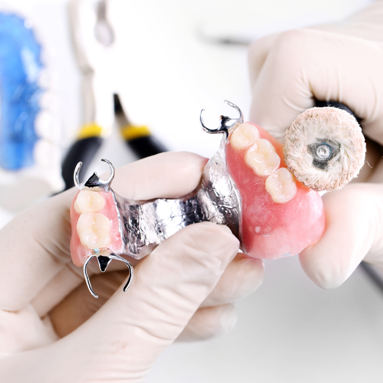 ODs Dental Laboratory- Tustin, CA - Partial Dentures